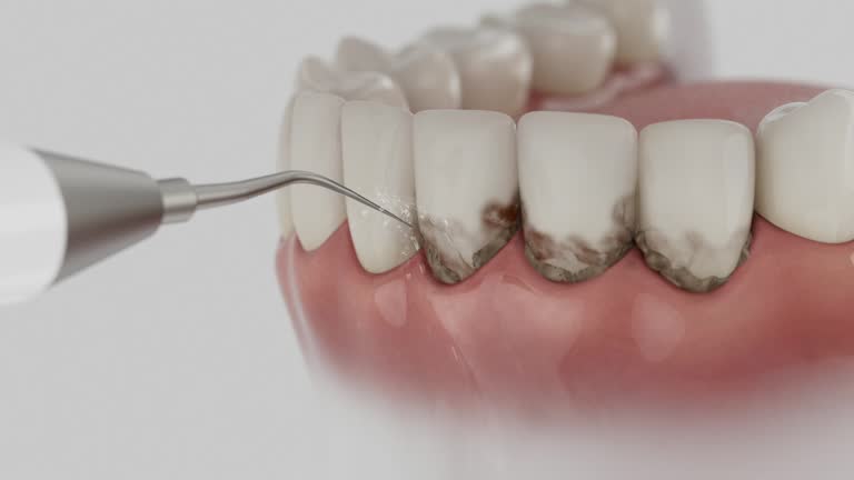 Reliable Dental Implants contractor in Allen, TX by Smile Center Dentistry